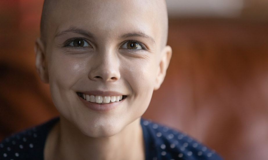 Young woman with hair loss